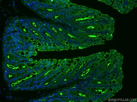 ZO-1 antibody (RMX00002) | Proteintech