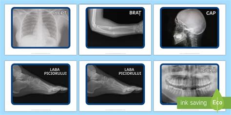 Fotografii cu radiografii
