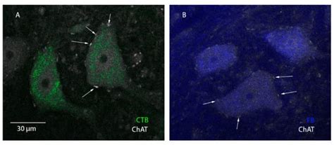 Fast Blue and Cholera Toxin-B Survival Guide for Alpha-Motoneurons ...