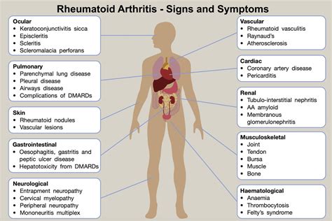 Rheumatoid Arthritis (RA): Causes, Symptoms Treatment FAQs, 52% OFF