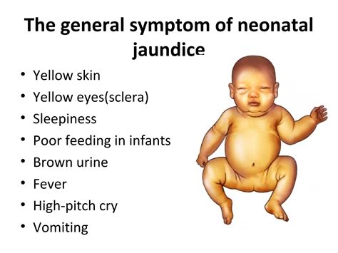 Image result for Neonatal Jaundice Algorithm