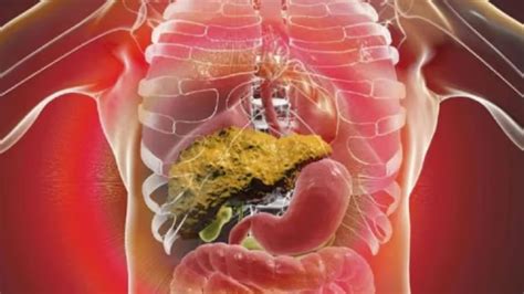 Liver Disease Symptoms: These early signs of Liver Disease are easily ...