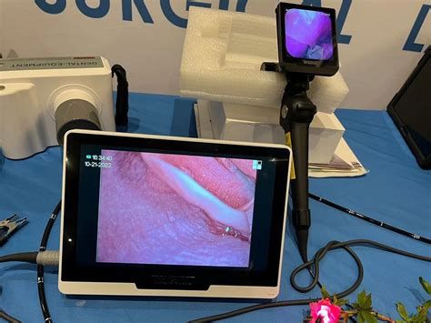 Medical Equipment - Endoscope Machine Wholesale Trader from New Delhi