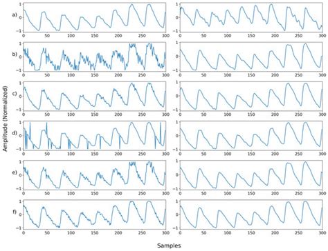 Preeminently Robust Neural PPG Denoiser