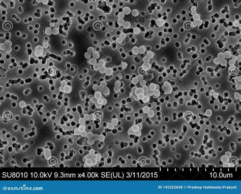 Staphylococcus Aureus Under Microscope 的图像结果