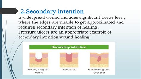 WOUND HEALING | PDF