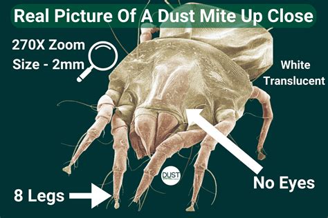 What Does A Dust Mite Look Like? Up Close – iDustMite