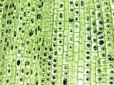 Plant Cell Under Microscope Labeled