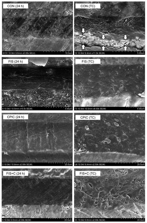 Dentin Biomodification with Flavonoids and Calcium Phosphate Ion ...