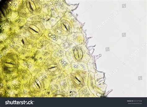 Light Microscope Micrograph 的图像结果