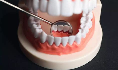 Higher salivary cytokines correspond with more significant gum ...