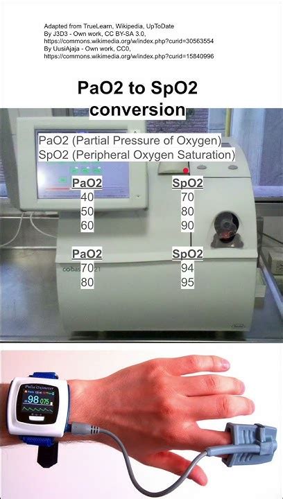 Image result for PaO2 SpO2