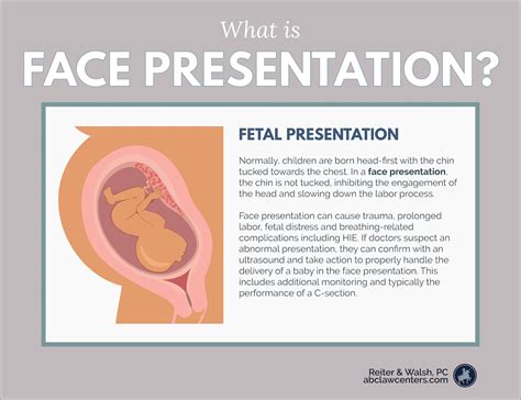Face Presentation and Birth Injury | Nursing school survival, Nursing ...