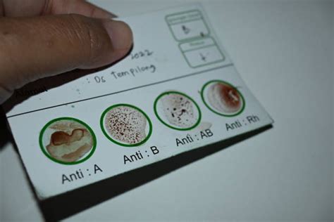 Image result for Agglutination Test