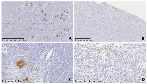 Immunohistochemical Expression of Tenascin-C in Canine Meningiomas
