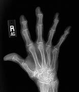 Image result for x-ray