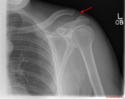 On Call Radiology - common radiology findings on call and in the Emergency Room and during the ...