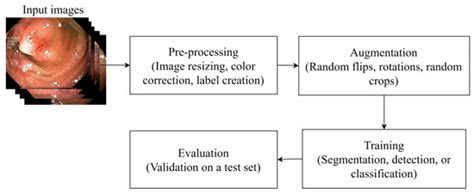 Detection of Colorectal Polyps from Colonoscopy Using Machine Learning ...