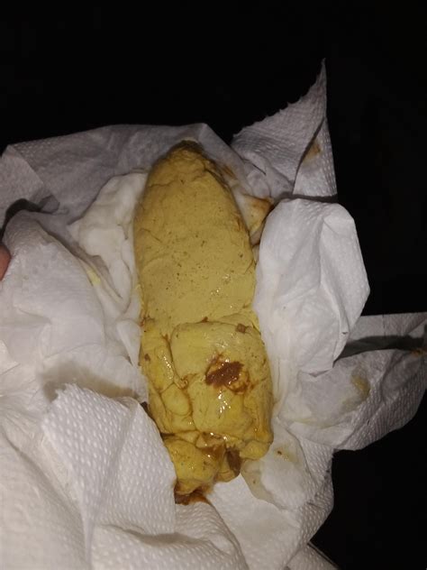 is this light colored stool and dark urine. I'm scared I have ...