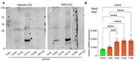 Valproic Acid Treatment after Traumatic Brain Injury in Mice Alleviates ...