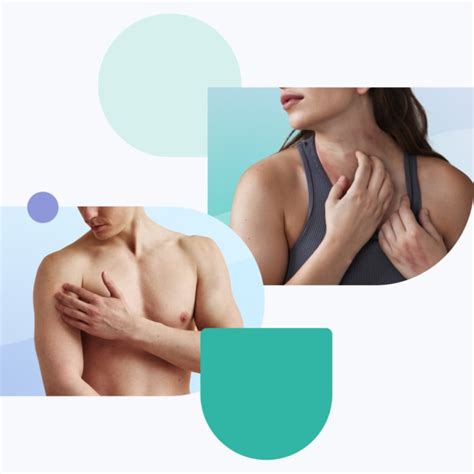 Learn More About Various Skin Diseases and Conditions