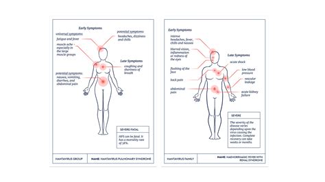 The Viral Most Wanted: The Hantaviruses