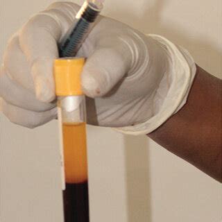 PRF Protocol 的图像结果