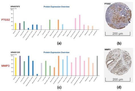 Screening Key Genes and Biological Pathways in Nasopharyngeal Carcinoma ...