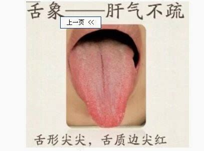 為什麼老中醫要看你的舌頭？原來舌頭這麼重要，教你看懂舌頭生病自己醫！ | 內幕人