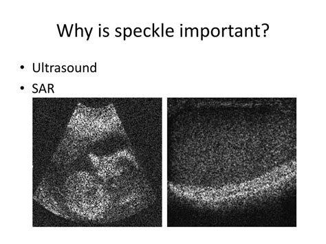 PPT - Modeling Speckle Noise in MATLAB for Imaging Applications PowerPoint Presentation - ID:8903983