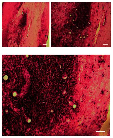 Recovery in Transplanted Rat after Stopping the Injected of ...