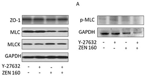 Zearalenone-Induced Mechanical Damage of Intestinal Barrier via the ...