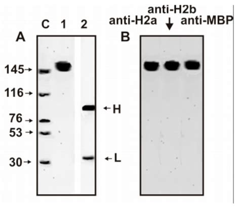 HIV-Infected Patients: Cross Site-Specific Hydrolysis of H2a and H2b ...