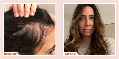 How to Make My Hair Thicker Naturally with Right Care and Nutrition ⋆ ...