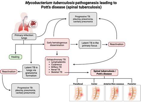 Tuberculosis Pathogenesis