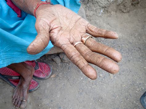 Lessons from Aadhaar: How not to make a mess of your national ID