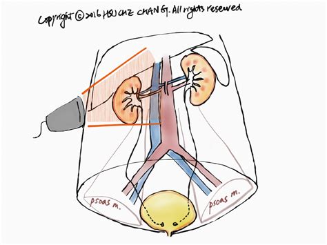 [Sonoanatomy] KuB — Kidney, ureter, Bladder - POCUS Academy