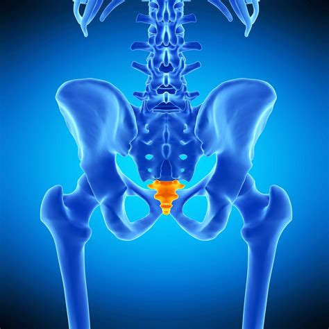 Ganglion Impar (Coccyx) Blocks – Spine Sports & Interventional Pain ...