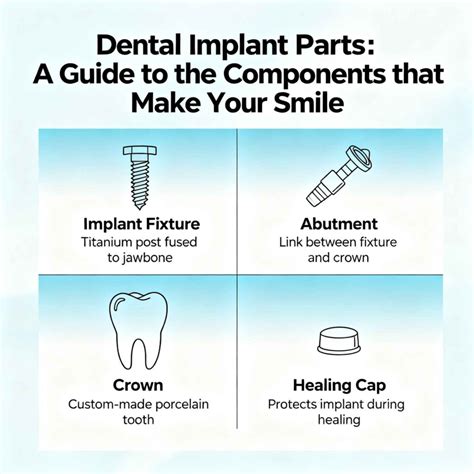 Dental Implant Parts: A Guide to the Components that Make Your Smile - Front Dental Implants