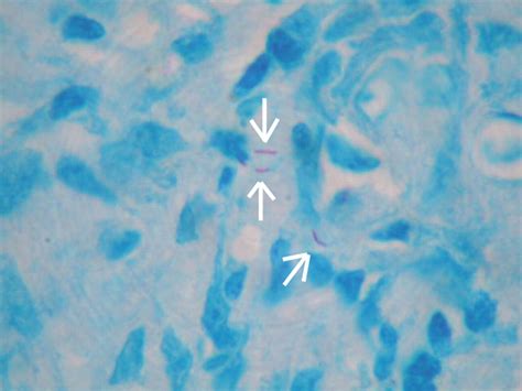 Image result for Acid-Fast Bacilli Staining Method
