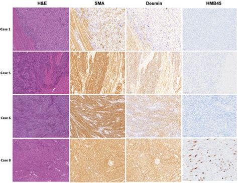 Cells | Special Issue : Molecular and Signaling Networks in Cancer ...