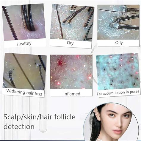 PLYLAY Skin Hair Analyzer,WiFi 5G 1000w Pixels 50x 200x India | Ubuy