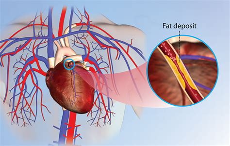 Health Condition : Symptoms, Causes, Treatment and More