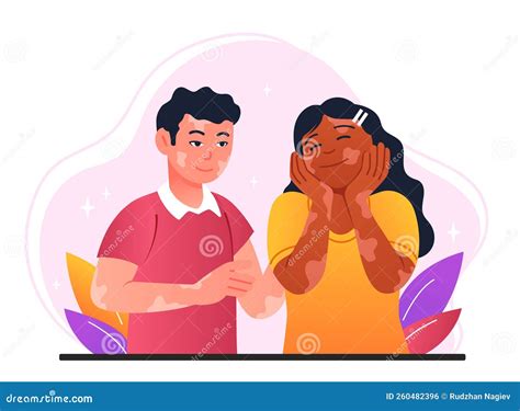 Vitiligo and skin disorder stock vector. Illustration of dermatology - 260482396 - how rare is vitiligo