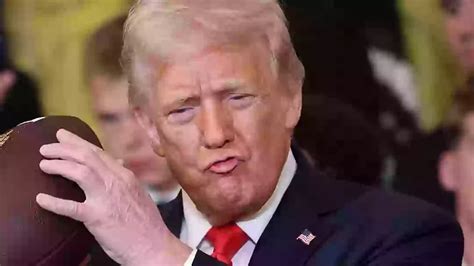 "Superstitious" Trump says higher aspirin dosage behind hand bruises