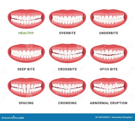 What Can A Human Jaw Bite Through at Dara Patao blog