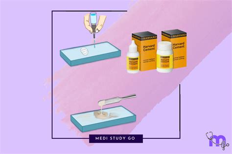 Zinc-Based Dental Cements: Properties, Applications – Medi Study Go