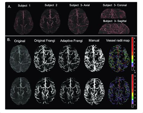 Image result for Maximum Intensity Projection Python