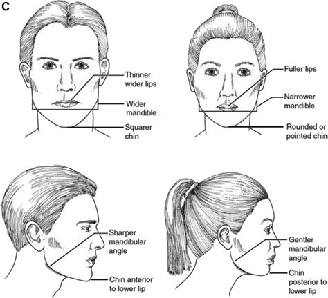 Gender Affirming Facial Surgery–Anatomy and Procedures for Facial Masculinization - Oral and ...