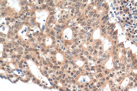 BHLHE40 antibody (17895-1-AP) | Proteintech